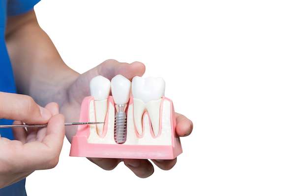Can You Get Dental Implants if You Have Gum Disease from Cedar Lane Family Dentistry in Franklin, IN