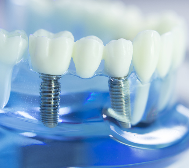 Franklin Dental Implants