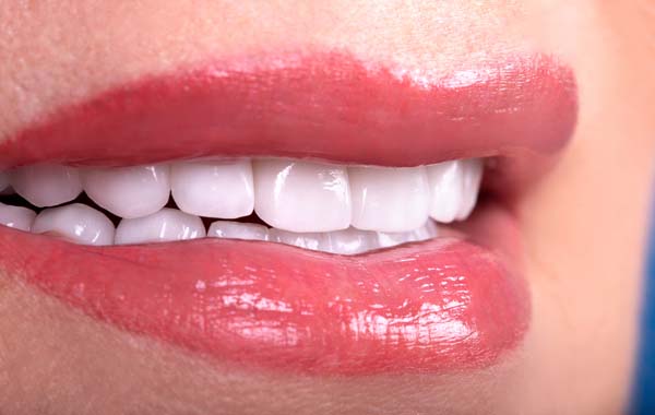 Questions To Ask A Dentist Before Getting Dentures