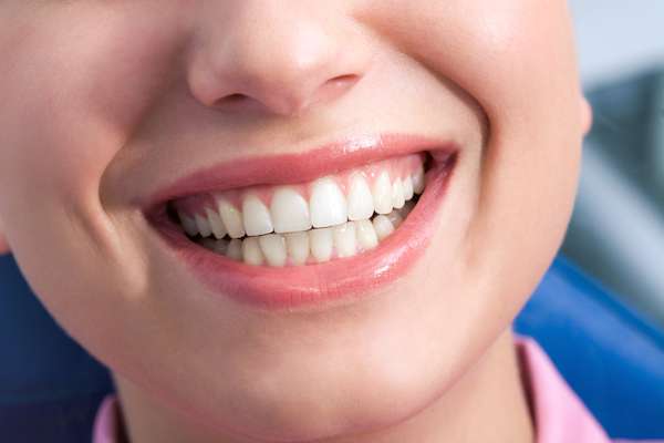 A General Dentist Discusses the Benefits of Tooth Straightening from Cedar Lane Family Dentistry in Franklin, IN