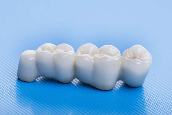 How Many Teeth Can Dental Bridges Replace from Cedar Lane Family Dentistry in Franklin, IN