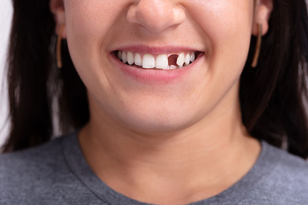 Options for Replacing Missing Teeth With Cosmetic Dental Services from Cedar Lane Family Dentistry in Franklin, IN