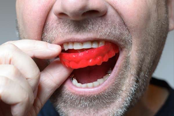 Save Your Teeth by Wearing Mouth Guards at Night from Cedar Lane Family Dentistry in Franklin, IN