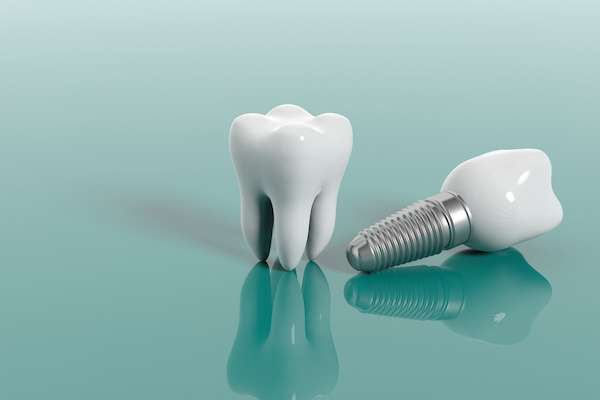 Multiple Teeth Replacement Options: One Implant for Two Teeth from Cedar Lane Family Dentistry in Franklin, IN
