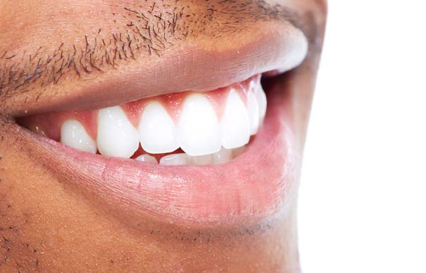 Teeth Whitening Franklin, IN