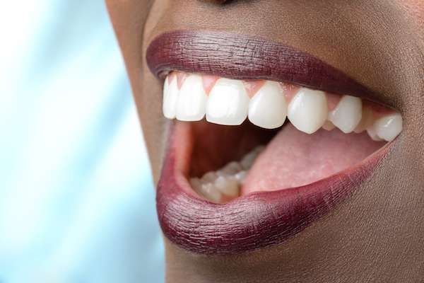 Routine Dental Care: What Are Tooth Colored Fillings
